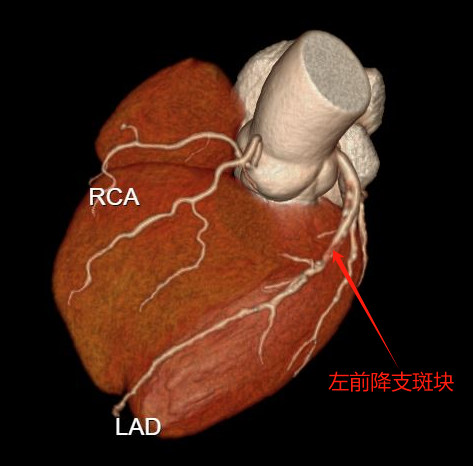 1-标记.jpg