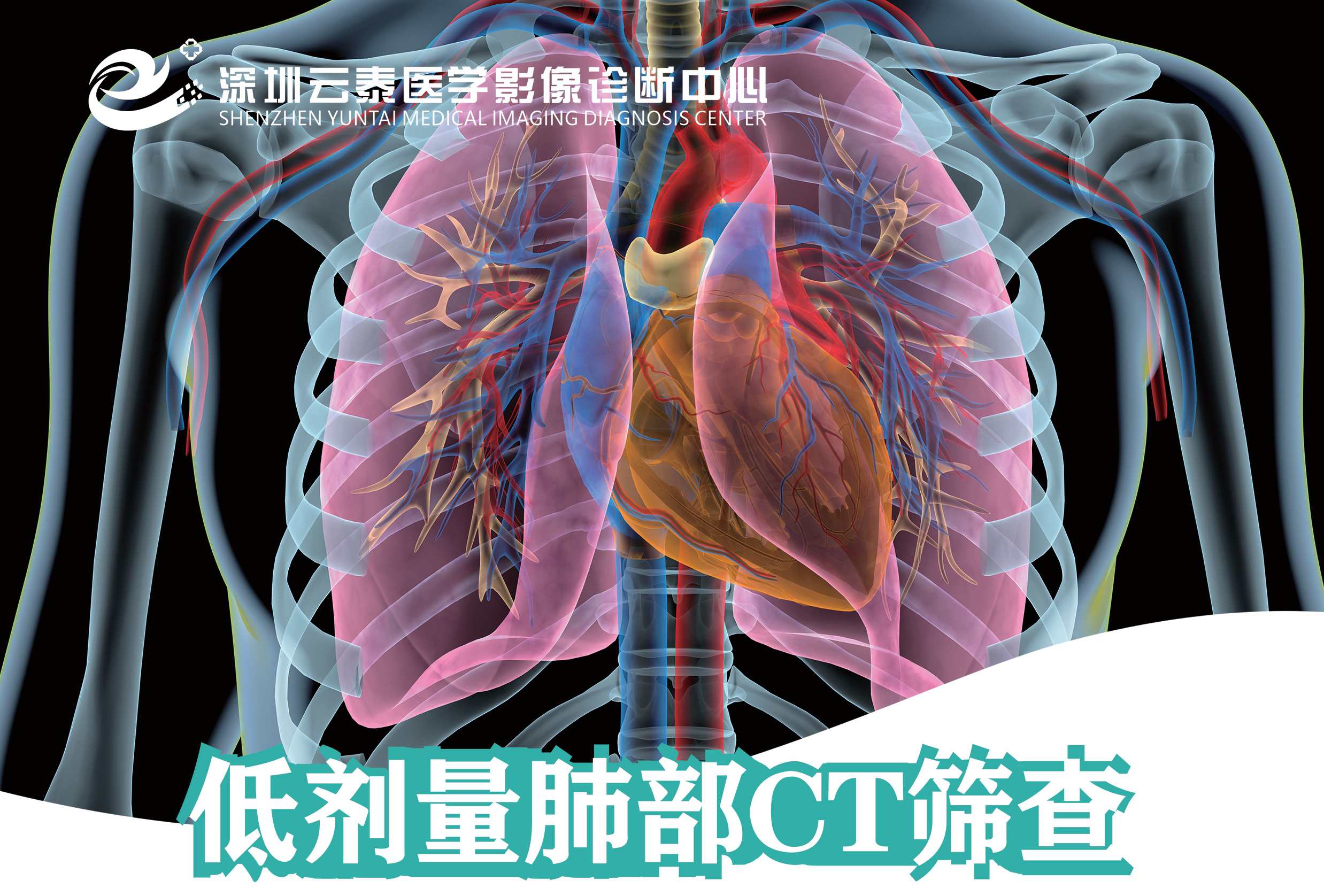 低剂量肺部CT筛查