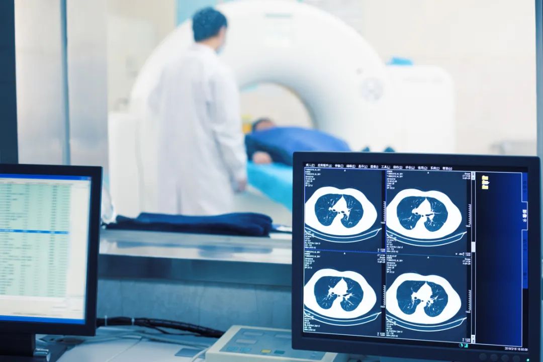 PET/CT：为隐匿性肺癌精准诊断提供有力支持